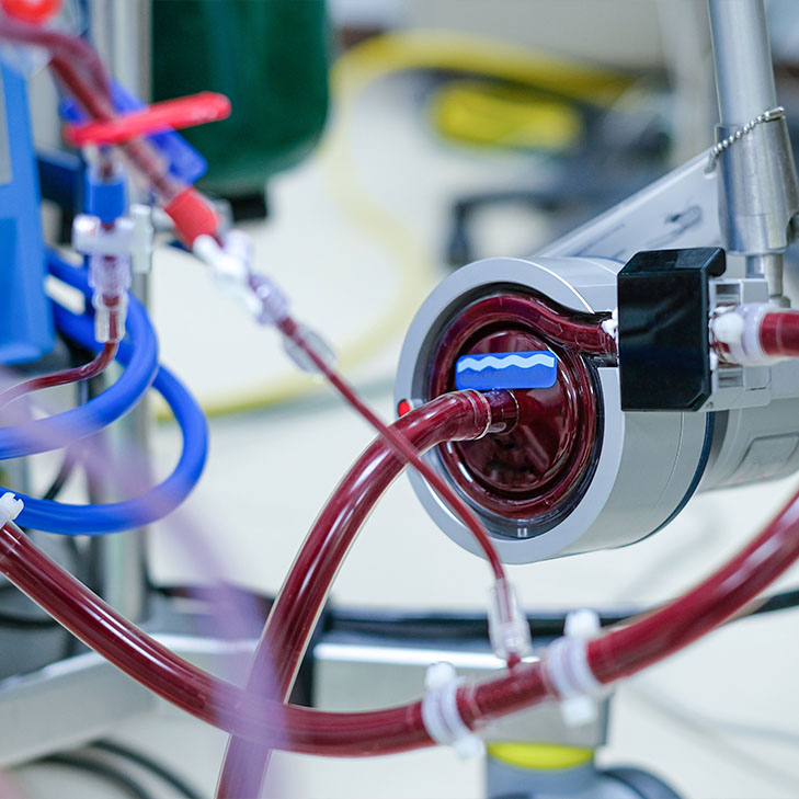 What Is ECMO?